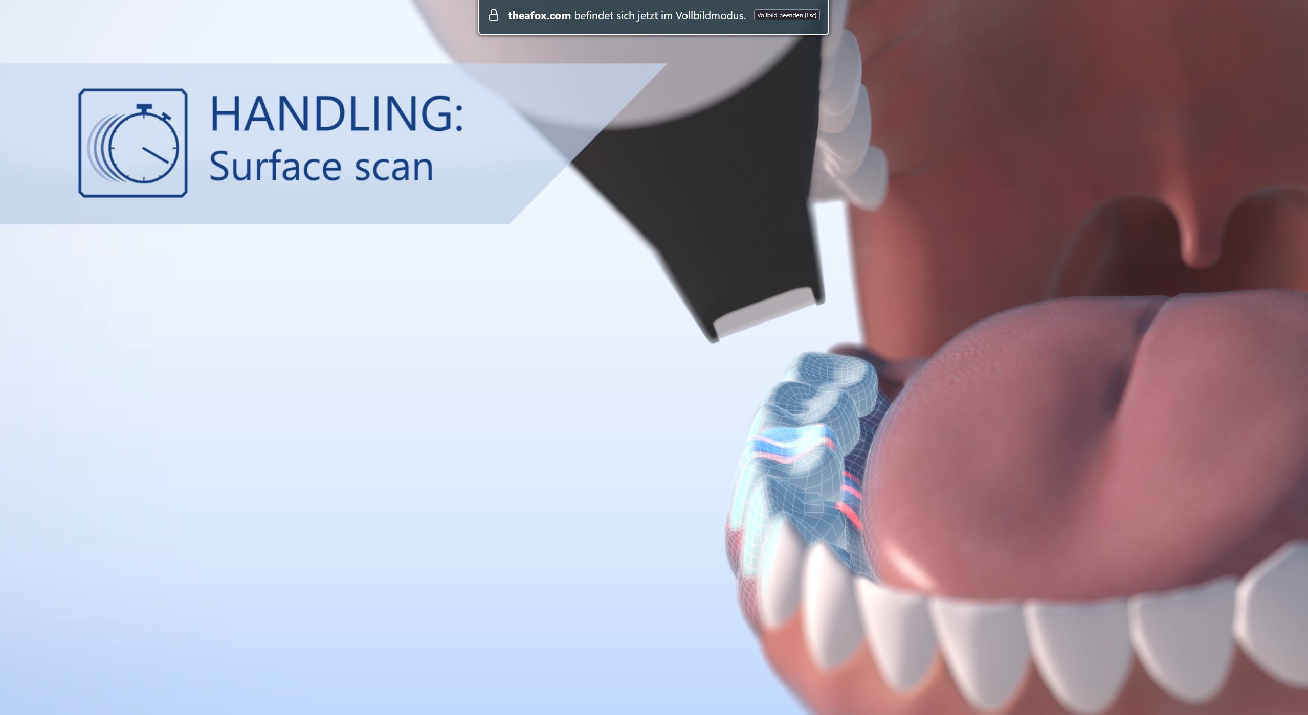 VOCO Intraoral Scanner – laser scanning visualization